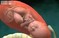 图解婴儿出生全过程 出生时身体变化