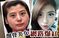 触目惊心！台湾26岁女子爆削骨整容全过程