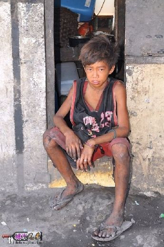 菲律宾最大墓地成最穷贫民窟 活人死人同住骷髅当玩具
