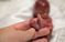 美国妈妈记录：19周早产儿的短暂生命（图）