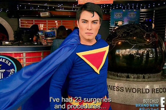 菲律宾男子整容23次成超人 花费30万比索