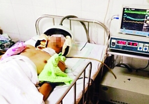 教师偷拍女生洗澡被打成重伤医院下病危通知书