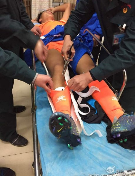 惨!曝U17球员被踢双腿骨折+颈腓骨颈骨粉碎(图)