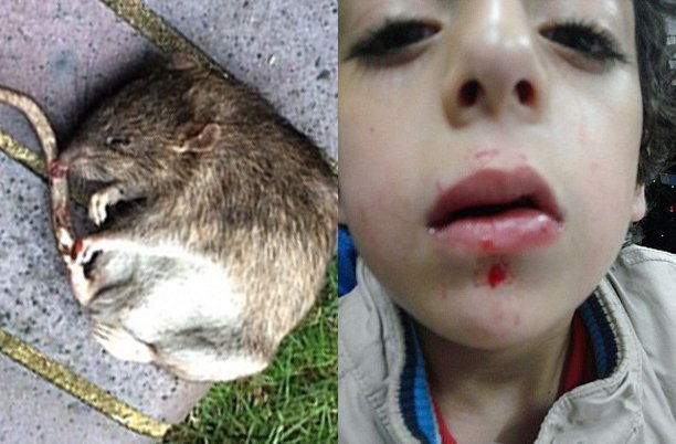 男童熟睡被30厘米巨鼠咬嘴脸 父亲救子将鼠击毙
