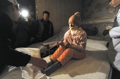 <em>安徽</em>17岁<em>女孩</em>周岩因拒绝同学求爱被浇汽油毁