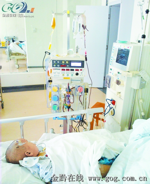 成功应用腹膜透析联合血浆置换救治2岁溶血尿