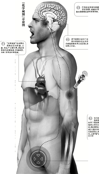 聚焦"化学阉割":不是宫刑图片