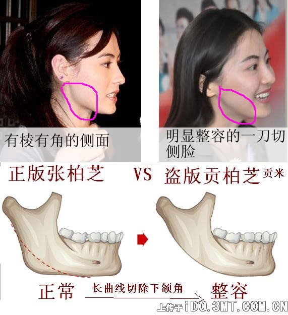 贡米与张柏芝侧面对比图