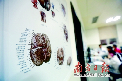脑中风预防门诊有望大范围开展