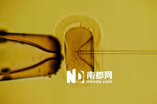 第四代试管婴儿:一个亲爹 两个亲娘?