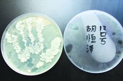 手上的细菌怎么如此多?