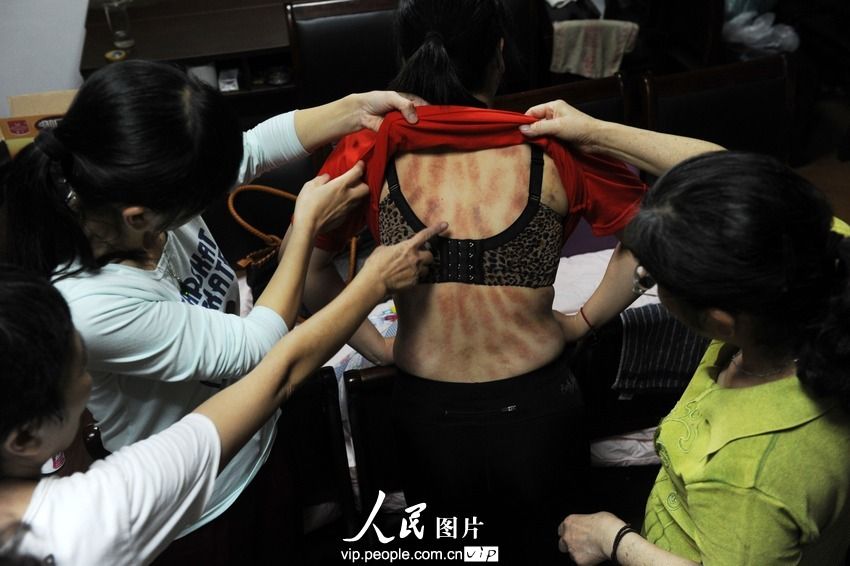 浙江余姚:灾民看望抗洪病倒女书记