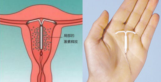 上吉妮环的过程图片