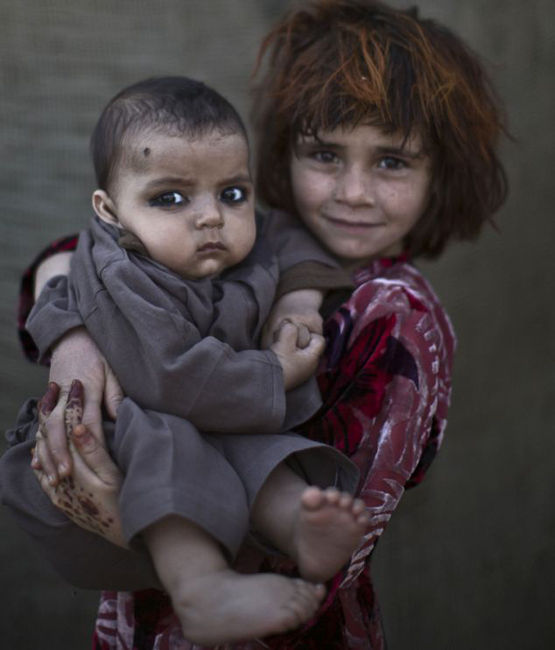 在巴基斯坦首都伊斯兰堡郊区的贫民窟里,有这样一群孩子,他们的脸脏