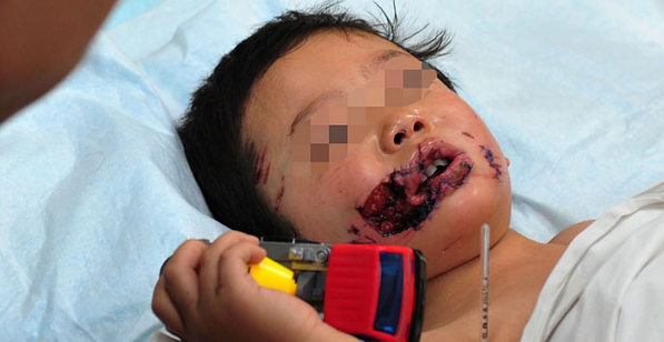 狗咬人不是新闻,是问题