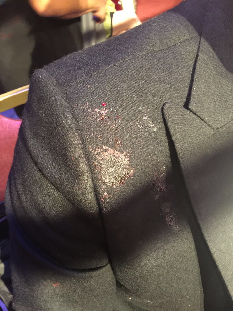 泰拳王播求被暴头鲜血喷射 与对手双双入院抢救(图)