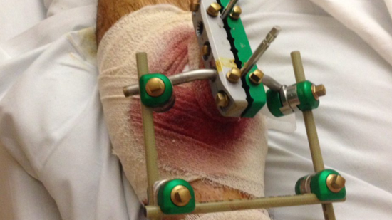 慎入!英球员恶意报复致人断腿 被重判入狱1年