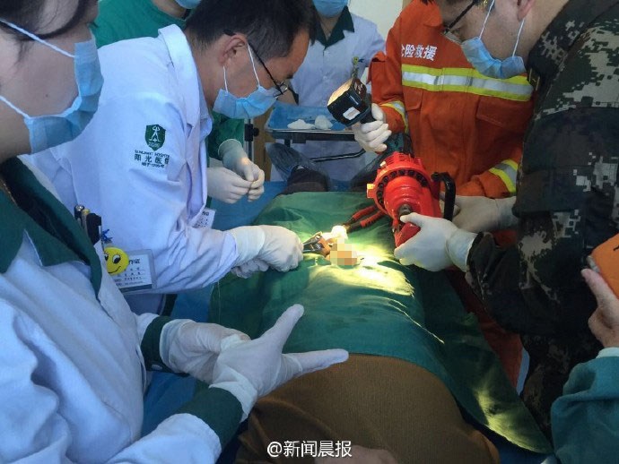 28岁已婚男子被铁螺帽套住目前在医院进行观察治疗