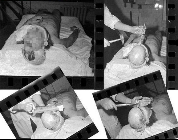 苏联时代最恐怖的古拉格劳改营囚犯要被活体取脑