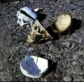 苏联时代最恐怖的古拉格劳改营囚犯要被活体取脑