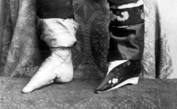 缠足——中国封建社会特有的习俗(组图)