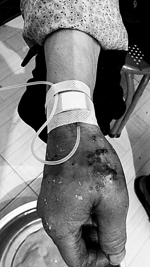 而动物专家初步断定其极似貉 是"狼"是"貉"不重要咬伤8人不是善茬