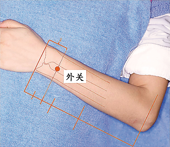 外关|泄热_凤凰资讯