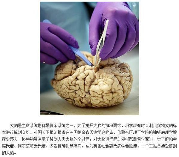 高清解析人脑解剖全过程图