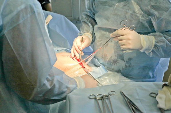 直击剖腹产分娩手术全过程