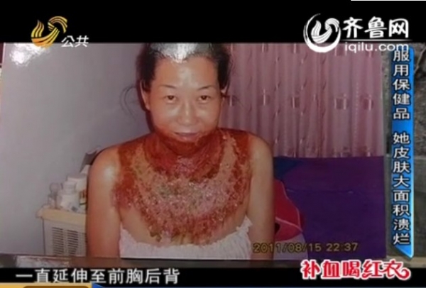 公共频道《新闻女生组》报道,菏泽43岁的小老板周希云本来相貌不错