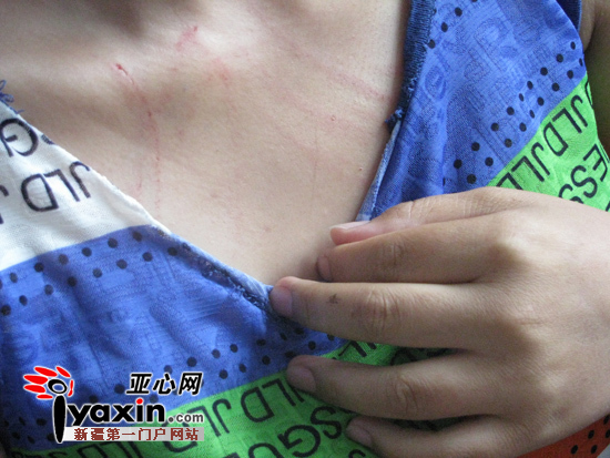 周女士摸着胸口的血印子委屈落泪.图 亚心网记者 王丽芳