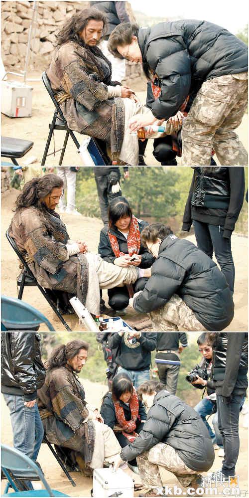 黄晓明拍戏脚趾粉碎性骨折