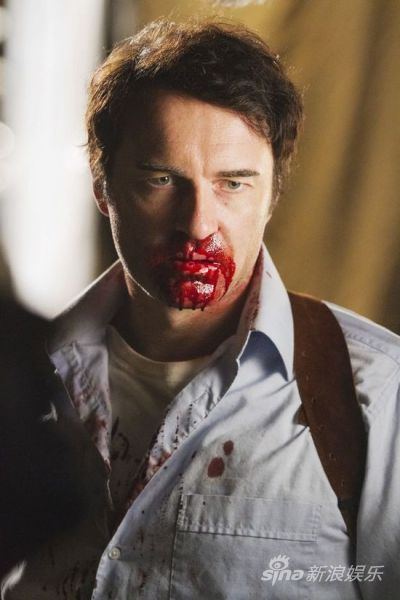 麦克马洪满脸血污